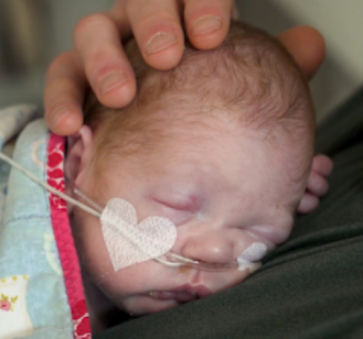 Photo of a newborn baby with a nasal tube with the adhesive tape cut into the shape of a heart